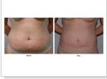 How Often You Wished To Owe Flat Abs?