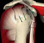 Rotator Cuff Carrollton