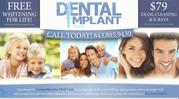 Dental implants Mt Pleasant sc 