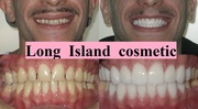 Gain a Beautiful Smile with Cosmetic Dentistry Long Island