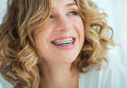 Get the best Braces Littleton!