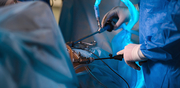 Gynecological Laparoscopic Surgery in Dubai